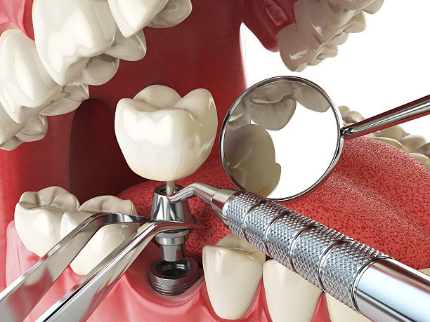 Best Broken or Cracked Tooth Emergency Dentist in Battle Ground, IN